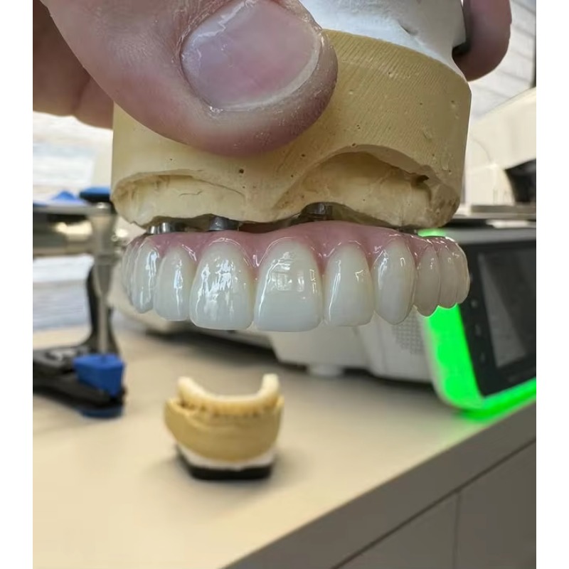 Dental-Labor 3D Master Zirkono – 3D Printing Lego Bewertung und Preis