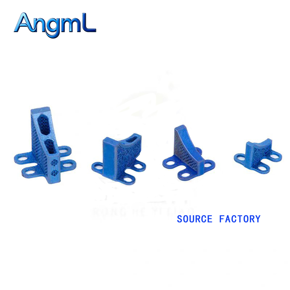 TC4 Titanlegierung 3D-gedruckt – 3D Printing Orthopedics Bewertung und Preis